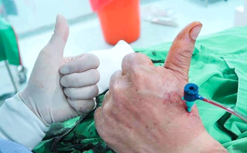 Pulgar Grande