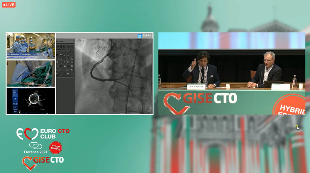 APT Medical en EuroCTO & CISE 2021 - 13th Experts live CTO